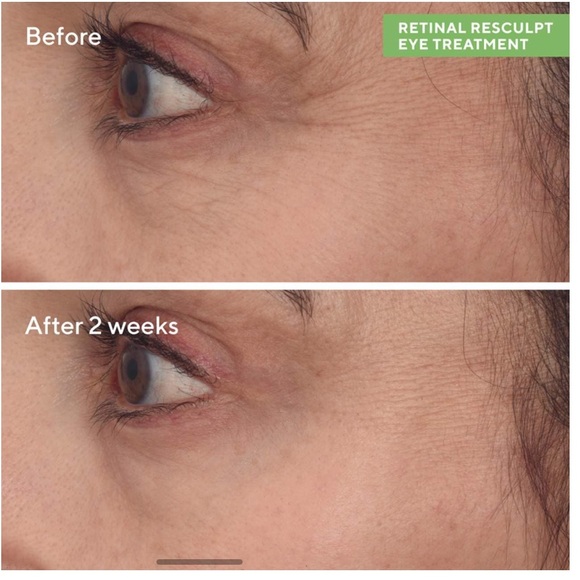 Pick 8/$50 Murad Retinal ReSculpt Eye Treatment🆕deluxe sample size - Picture 6 of 10